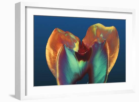 Polarised LM of a Molar Tooth Showing Decay-Volker Steger-Framed Photographic Print