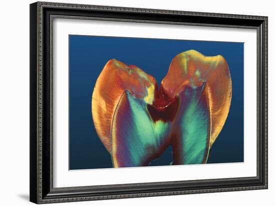 Polarised LM of a Molar Tooth Showing Decay-Volker Steger-Framed Photographic Print