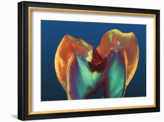 Polarised LM of a Molar Tooth Showing Decay-Volker Steger-Framed Photographic Print