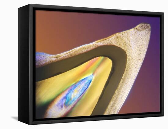 Polarised LM of a Tooth with a Dental Crown-Volker Steger-Framed Premier Image Canvas