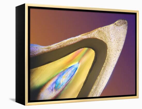 Polarised LM of a Tooth with a Dental Crown-Volker Steger-Framed Premier Image Canvas