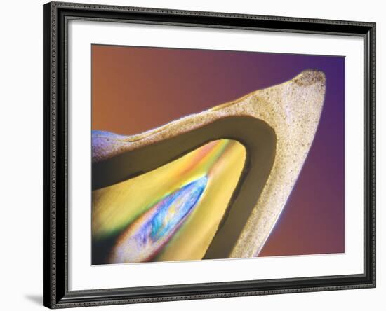 Polarised LM of a Tooth with a Dental Crown-Volker Steger-Framed Photographic Print