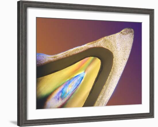 Polarised LM of a Tooth with a Dental Crown-Volker Steger-Framed Photographic Print