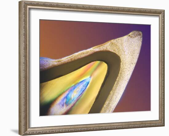 Polarised LM of a Tooth with a Dental Crown-Volker Steger-Framed Photographic Print