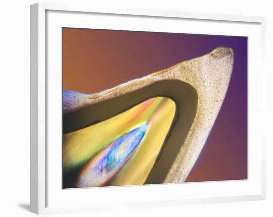 Polarised LM of a Tooth with a Dental Crown-Volker Steger-Framed Photographic Print