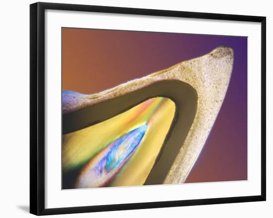 Polarised LM of a Tooth with a Dental Crown-Volker Steger-Framed Photographic Print