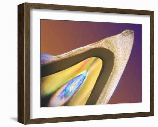 Polarised LM of a Tooth with a Dental Crown-Volker Steger-Framed Photographic Print