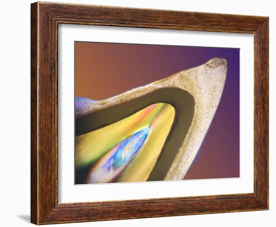 Polarised LM of a Tooth with a Dental Crown-Volker Steger-Framed Photographic Print