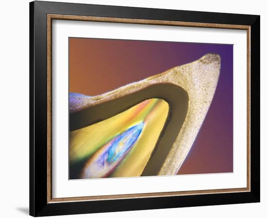 Polarised LM of a Tooth with a Dental Crown-Volker Steger-Framed Photographic Print