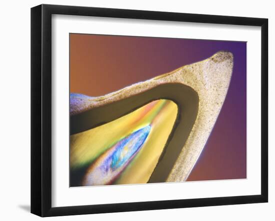 Polarised LM of a Tooth with a Dental Crown-Volker Steger-Framed Photographic Print