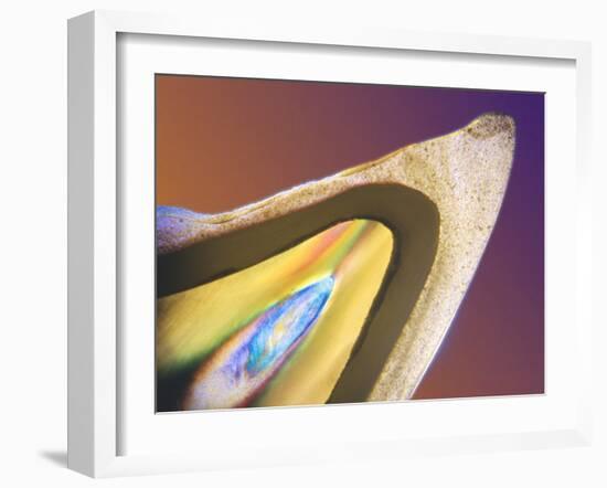 Polarised LM of a Tooth with a Dental Crown-Volker Steger-Framed Photographic Print