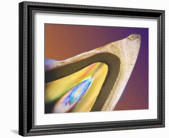 Polarised LM of a Tooth with a Dental Crown-Volker Steger-Framed Photographic Print
