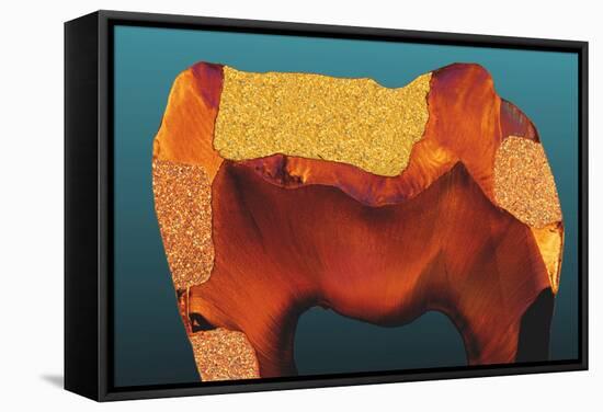 Polarised LM of a Tooth with Various Fillings-Volker Steger-Framed Premier Image Canvas