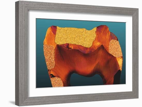 Polarised LM of a Tooth with Various Fillings-Volker Steger-Framed Photographic Print