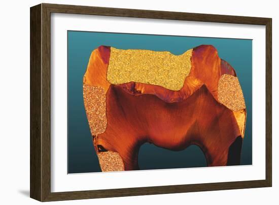 Polarised LM of a Tooth with Various Fillings-Volker Steger-Framed Photographic Print