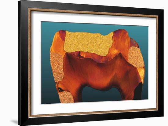 Polarised LM of a Tooth with Various Fillings-Volker Steger-Framed Photographic Print