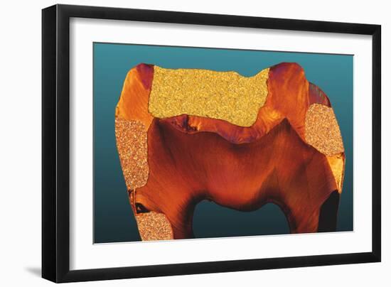 Polarised LM of a Tooth with Various Fillings-Volker Steger-Framed Photographic Print