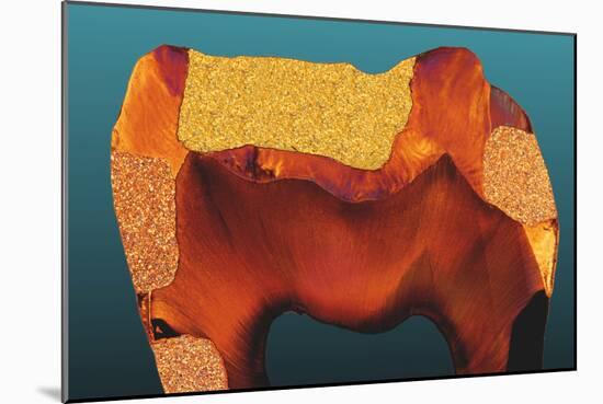 Polarised LM of a Tooth with Various Fillings-Volker Steger-Mounted Photographic Print