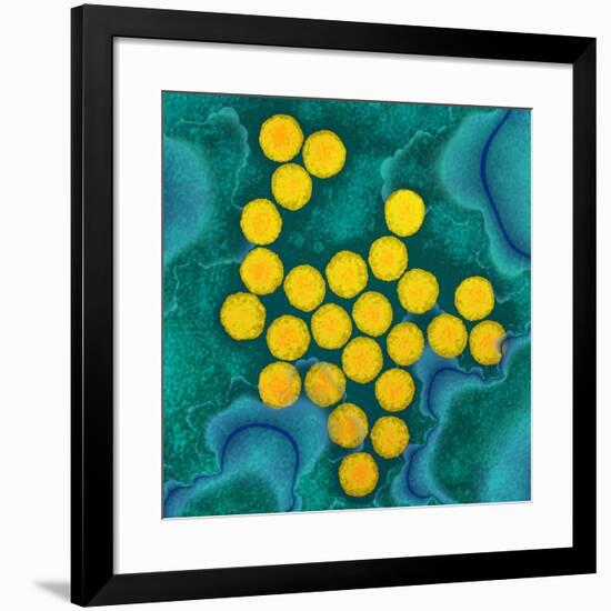 Polio Viruses, TEM-Dr. Linda Stannard-Framed Photographic Print