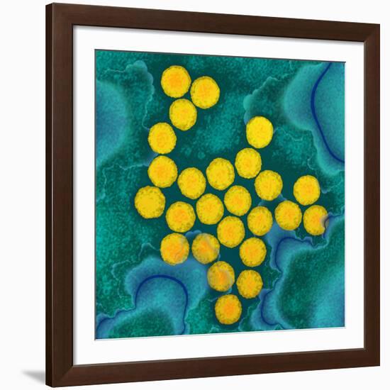 Polio Viruses, TEM-Dr. Linda Stannard-Framed Photographic Print