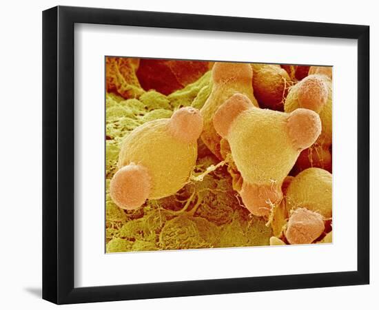 Pollen of Evening Primrose-Micro Discovery-Framed Photographic Print