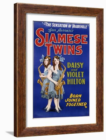 Poster Advertisement for Siamese Twins Daisy and Violet Hilton--Framed Giclee Print