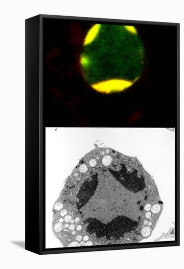 Programmed Cell Death-Science Photo Library-Framed Premier Image Canvas