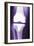 Prosthetic Knee, X-ray-Miriam Maslo-Framed Photographic Print