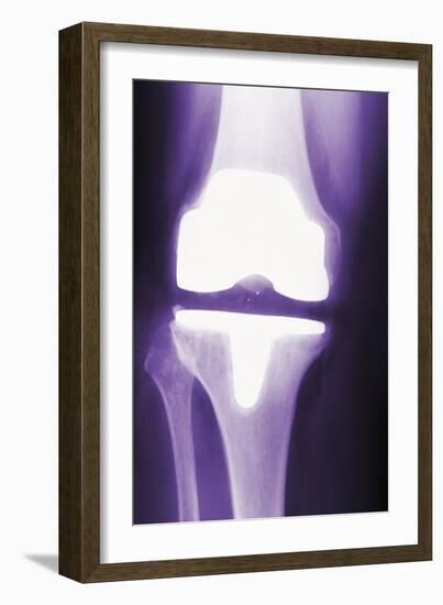 Prosthetic Knee, X-ray-Miriam Maslo-Framed Photographic Print