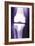 Prosthetic Knee, X-ray-Miriam Maslo-Framed Photographic Print