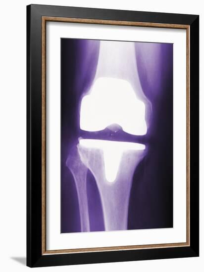 Prosthetic Knee, X-ray-Miriam Maslo-Framed Photographic Print