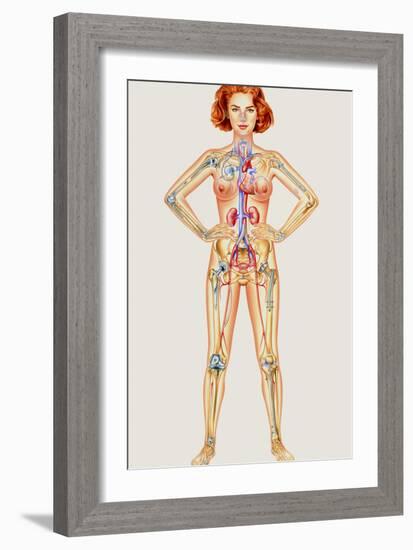 Prosthetic Woman: Artwork of Artificial Implants-John Bavosi-Framed Photographic Print