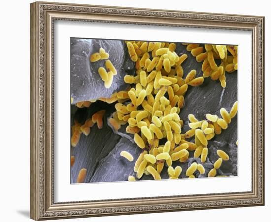 Pseudomonas Aeruginosa Bacteria, SEM-Steve Gschmeissner-Framed Photographic Print