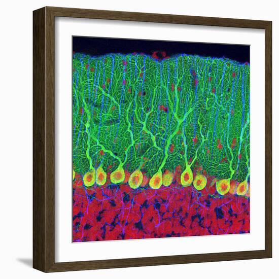 Purkinje Nerve Cells In the Cerebellum-Thomas Deerinck-Framed Premium Photographic Print