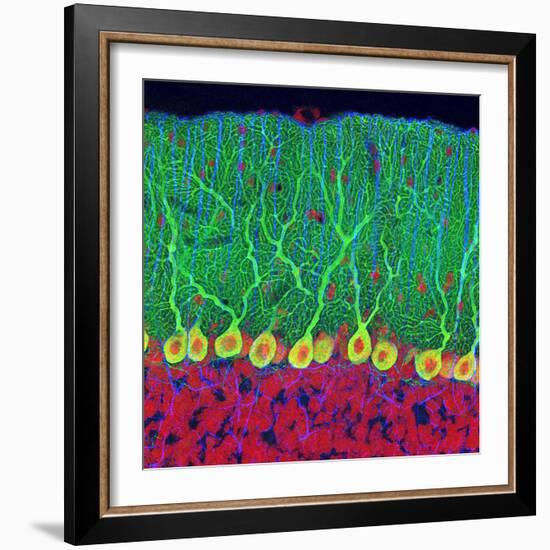 Purkinje Nerve Cells In the Cerebellum-Thomas Deerinck-Framed Premium Photographic Print