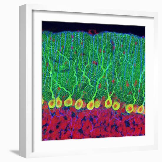 Purkinje Nerve Cells In the Cerebellum-Thomas Deerinck-Framed Premium Photographic Print