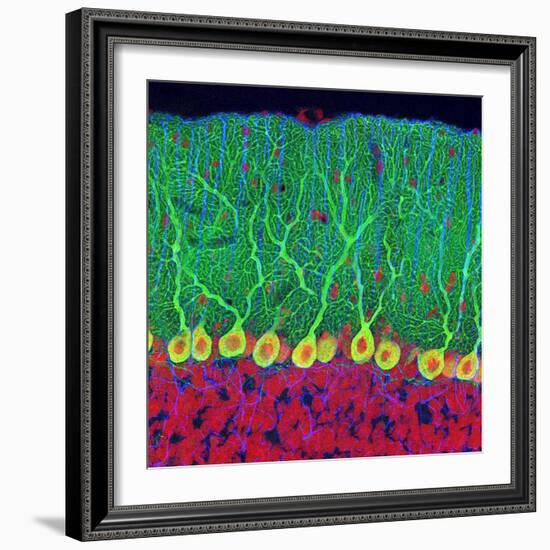 Purkinje Nerve Cells In the Cerebellum-Thomas Deerinck-Framed Premium Photographic Print