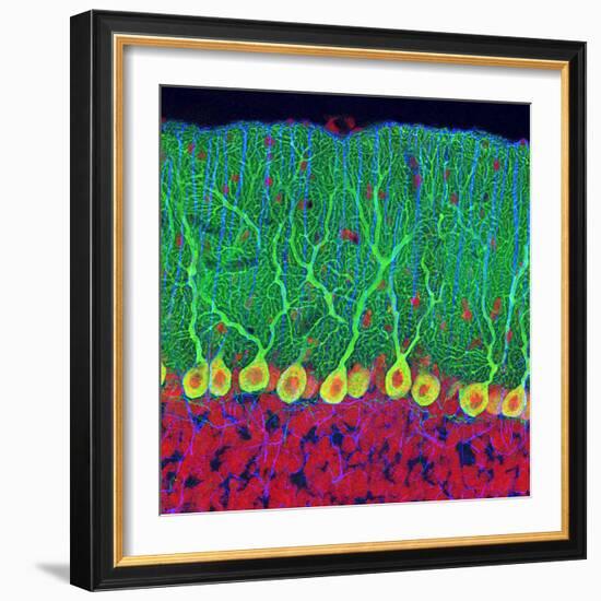 Purkinje Nerve Cells In the Cerebellum-Thomas Deerinck-Framed Premium Photographic Print