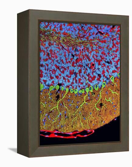 Purkinje Nerve Cells In the Cerebellum-Thomas Deerinck-Framed Premier Image Canvas