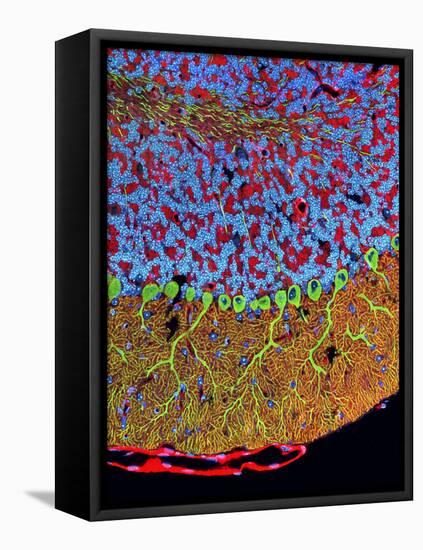 Purkinje Nerve Cells In the Cerebellum-Thomas Deerinck-Framed Premier Image Canvas