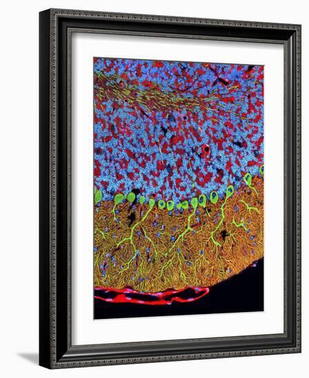 Purkinje Nerve Cells In the Cerebellum-Thomas Deerinck-Framed Photographic Print