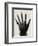 'Radiograph of the Hand of H.R.H. The Prince of Wales', (c1897)-Unknown-Framed Giclee Print