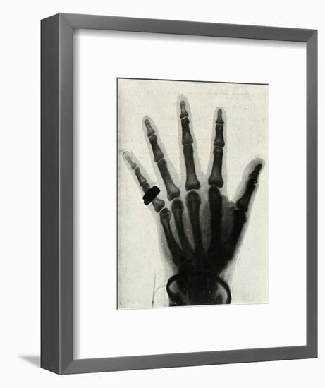 'Radiograph of the Hand of H.R.H. The Prince of Wales', (c1897)-Unknown-Framed Giclee Print