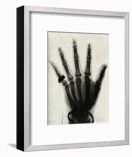 'Radiograph of the Hand of H.R.H. The Prince of Wales', (c1897)-Unknown-Framed Giclee Print