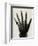 'Radiograph of the Hand of H.R.H. The Prince of Wales', (c1897)-Unknown-Framed Giclee Print