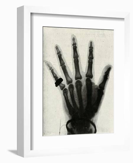 'Radiograph of the Hand of H.R.H. The Prince of Wales', (c1897)-Unknown-Framed Giclee Print