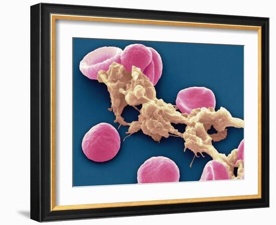 Red Blood Cells And Platelets, SEM-Steve Gschmeissner-Framed Photographic Print