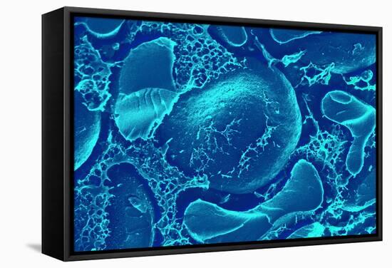 Red Blood Cells, SEM-Science Photo Library-Framed Premier Image Canvas