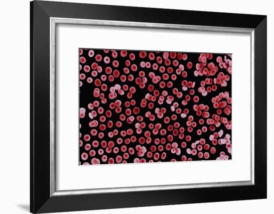 Red Blood Cells, SEM-Dr. Yorgos Nikas-Framed Photographic Print