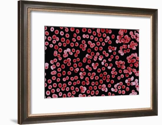 Red Blood Cells, SEM-Dr. Yorgos Nikas-Framed Photographic Print